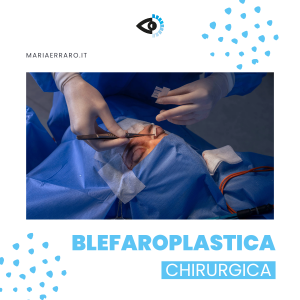 Blefaroplastica milano