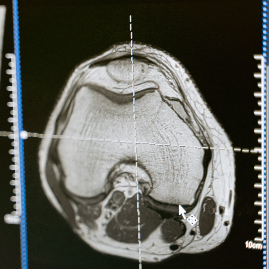 Feature image